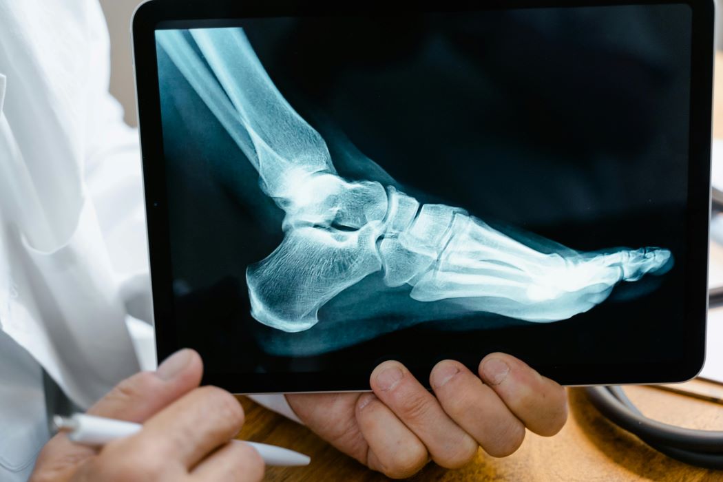 Eating Well to Support Bone Health – Colony